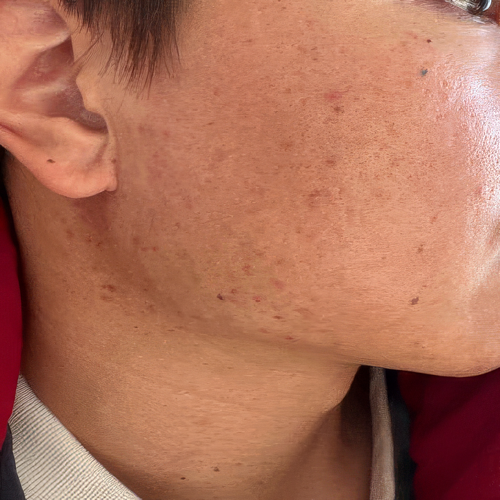 After